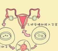 试管婴儿可以选择试管吗？试管婴儿各个环节的费用